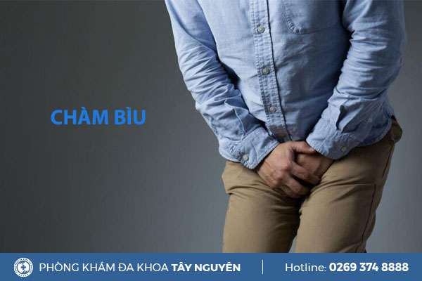 Tìm hiểu về thuốc bôi đặc trị chàm bìu hiệu quả