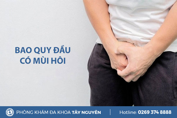 Nguyên nhân khiến bao quy đầu có mùi hôi là gì?