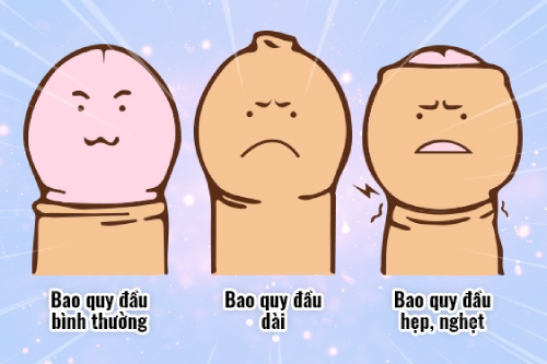 Cắt bao quy đầu là gì?